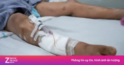 Vết xước nhỏ do cành rào quệt vào chân khiến người đàn ông 65 tuổi nguy kịch vì uốn ván