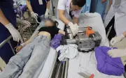 Bệnh viện Bãi Cháy cấp cứu nữ bệnh nhân 19 tuổi bị máy xay thịt cuốn nát bàn tay