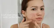 Da dầu mụn có cần dưỡng ẩm mùa nắng nóng? Chuyên gia giải đáp