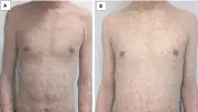 Nhiều trẻ nhập viện vì vảy cá bẩm sinh nặng do chăm sóc da không đúng cách
